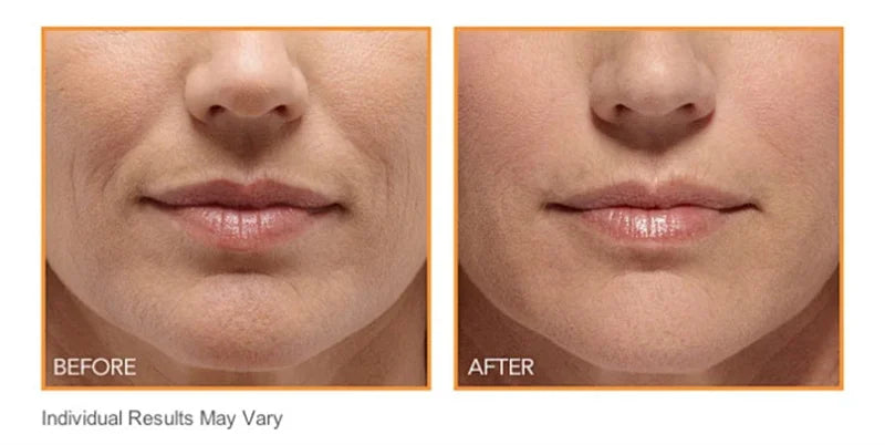 Hydrocrystalline Firming Patch | Anti-Aging Skincare Solution